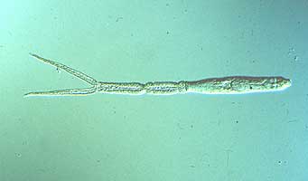 Austrobilharzia_variglandis_cercaria